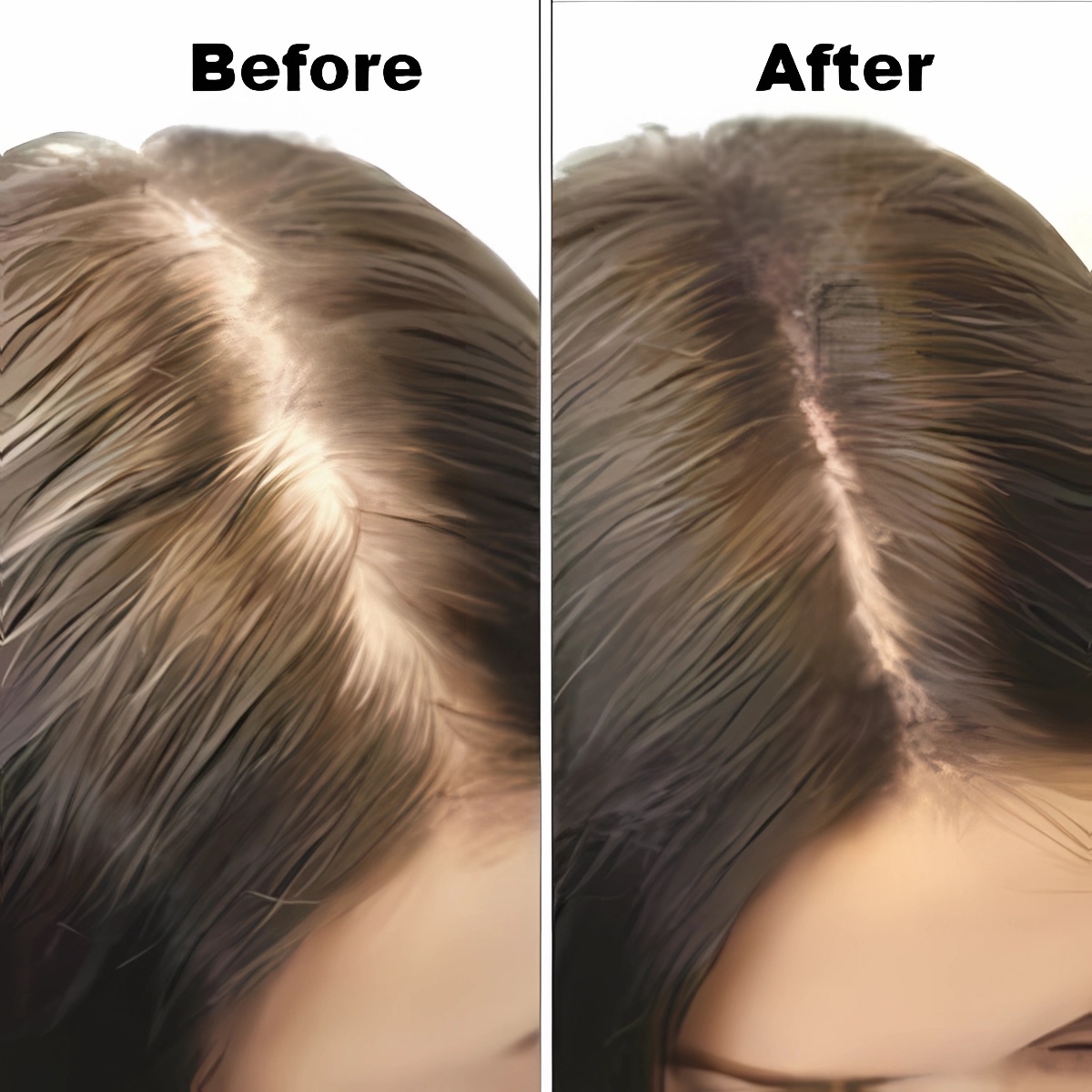 Hair Growth Cap - Red Light Comb for Women and Men,make the hair regrowth and healthier