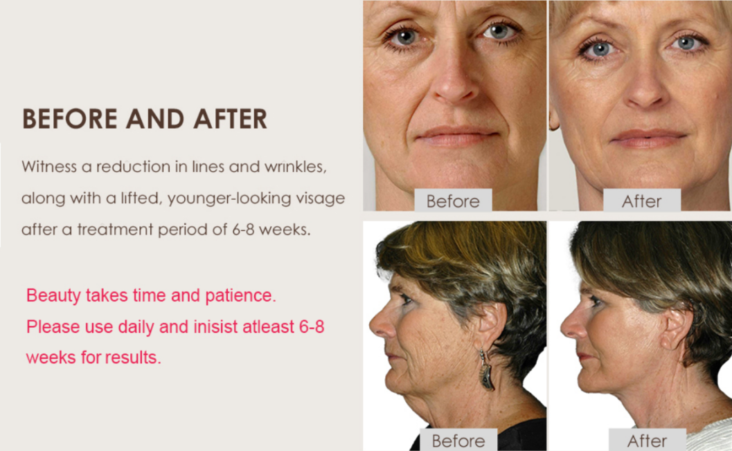 650nm Red Light Therapy Device – Rejuvenate Your Skin