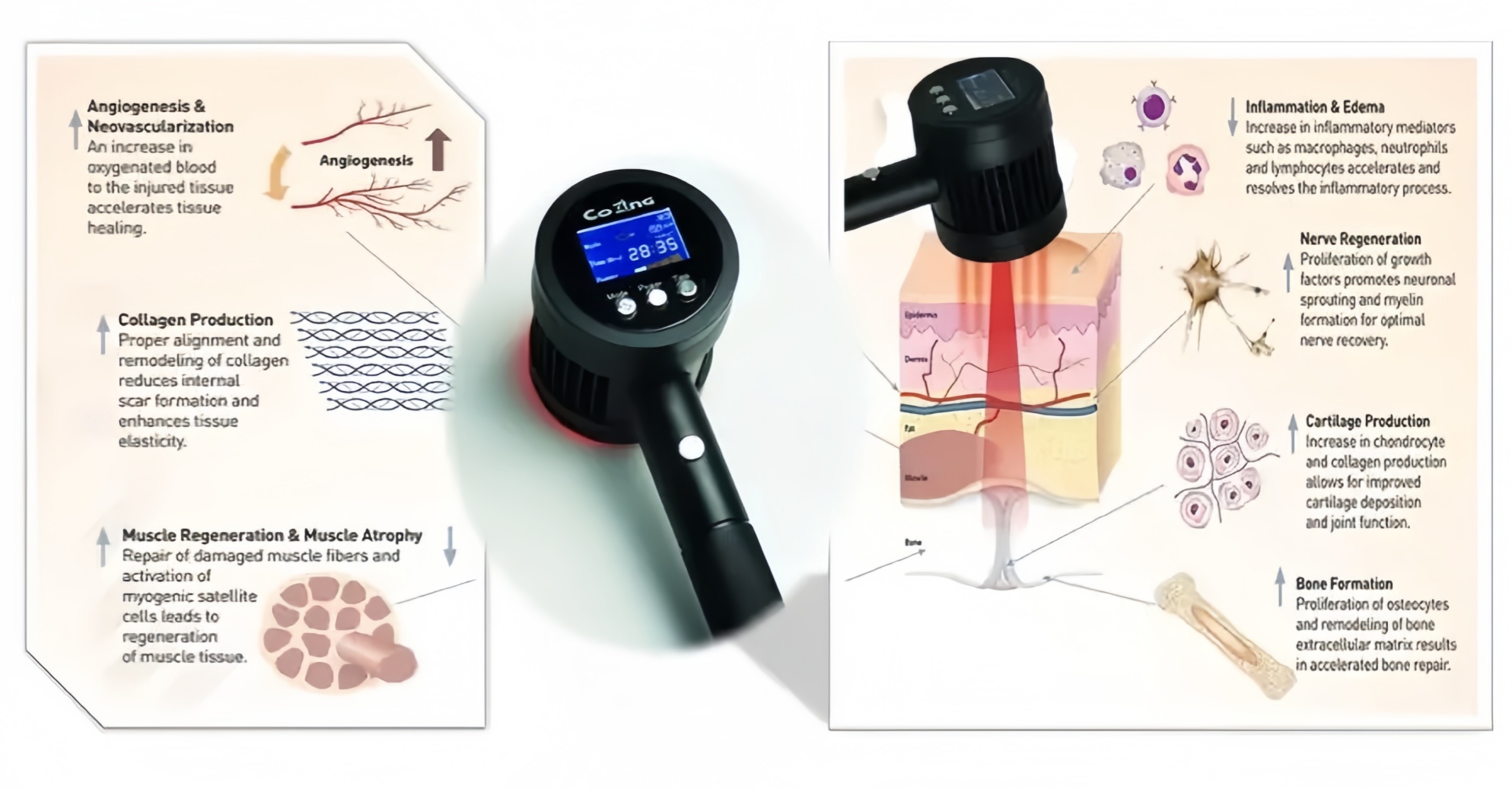 COZING-T05-8  50W super pulse 905nm and 650nm Professional Dual-Wavelength Laser Therapy System