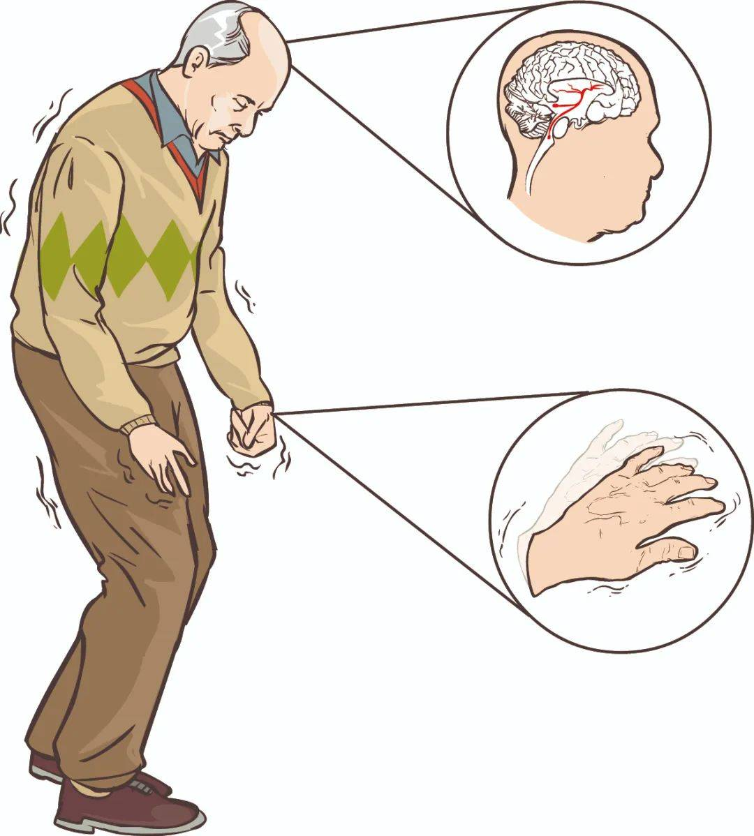 COZING Photobiomodulation Helmet – Advanced Neurological Therapy Device