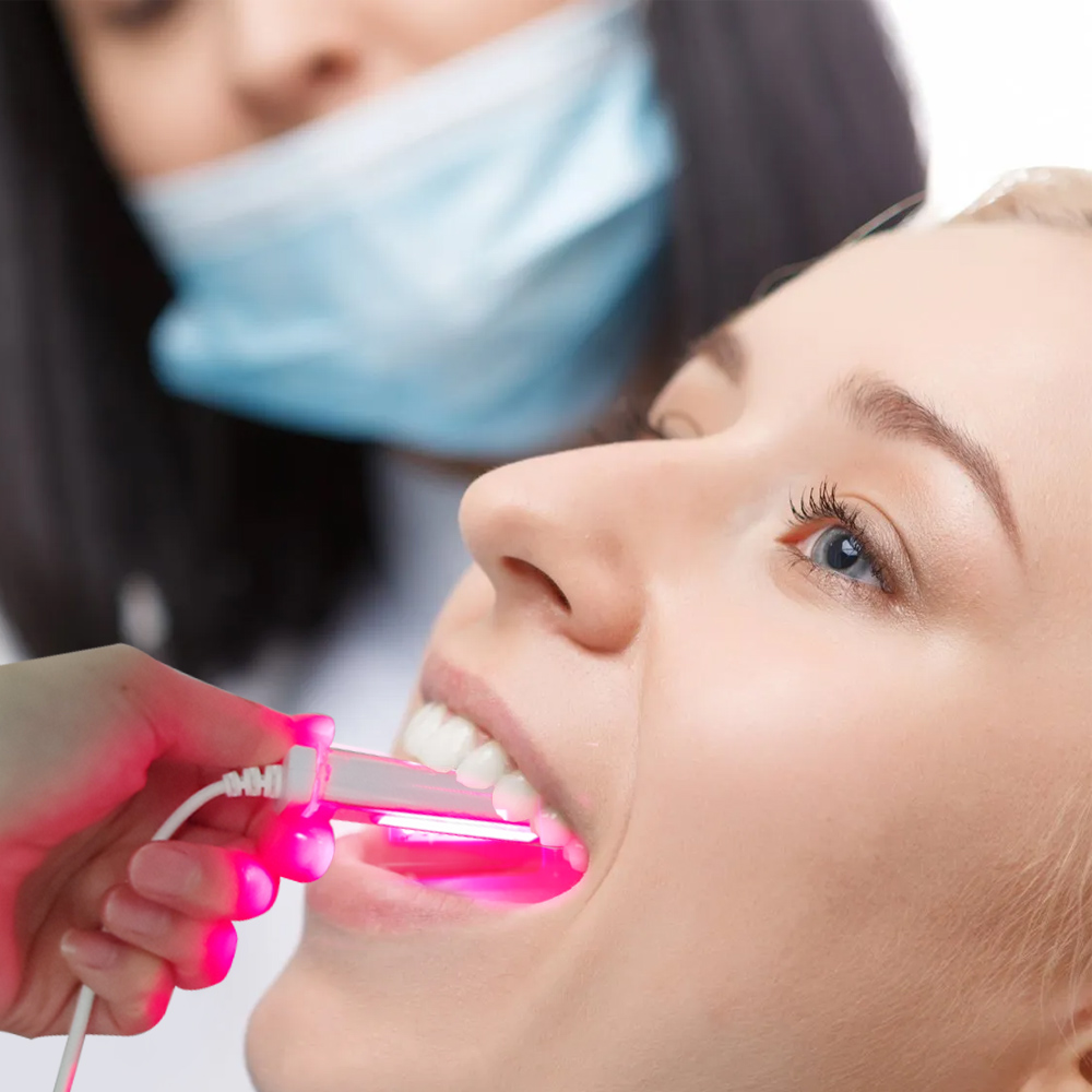 650nm Laser Therapy Device Oral Therapy Dental Machine for Mouth ulcers and Gum inflammation Home Use