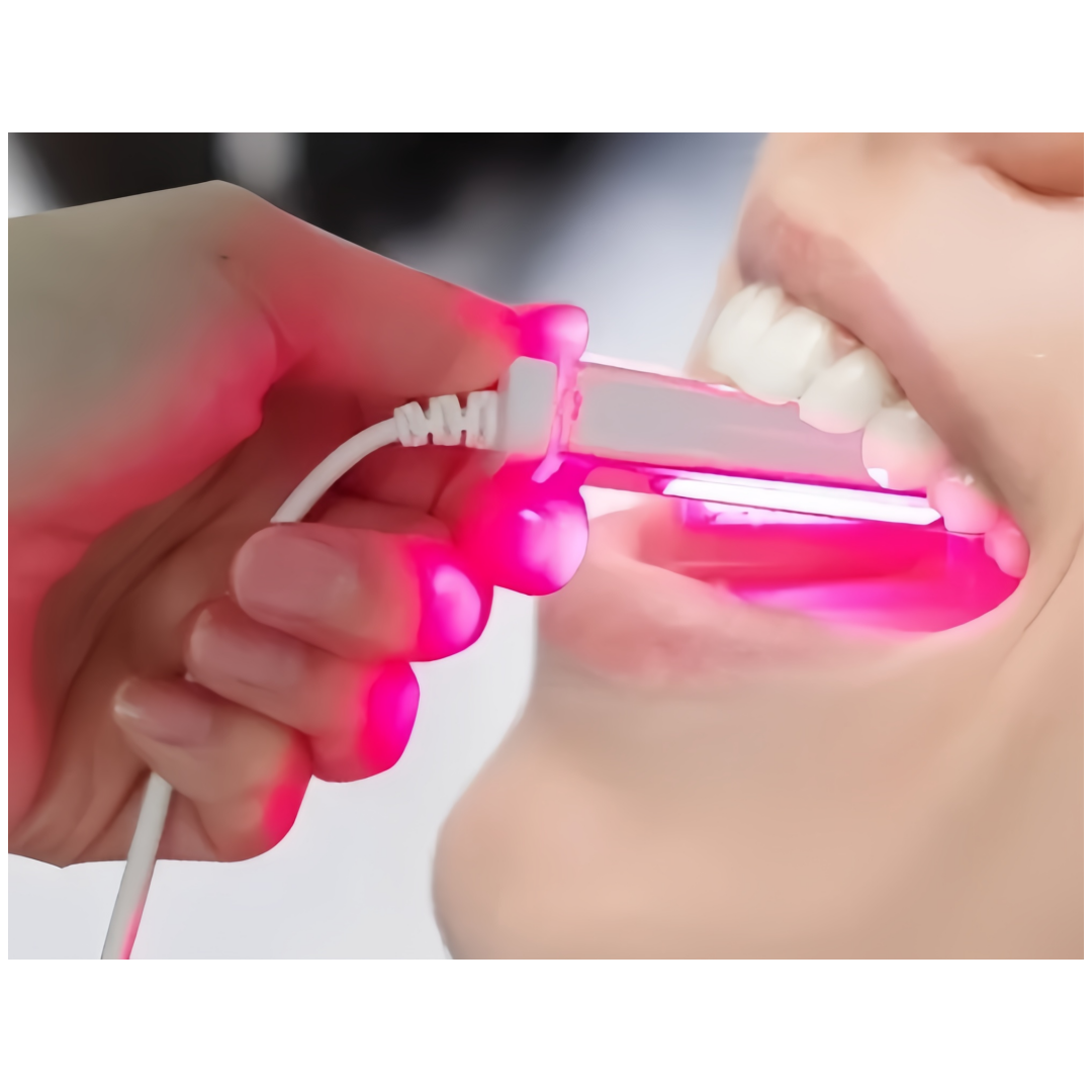 650nm Laser Therapy Device Oral Therapy Dental Machine for Mouth ulcers and Gum inflammation Home Use