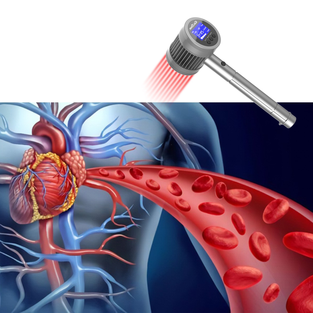 COZING-T05-7 650nm 808nm 904nm 980nm Multi-Wavelength Superpulse Laser Therapy System - Clinical-Grade Photobiomodulation Solution