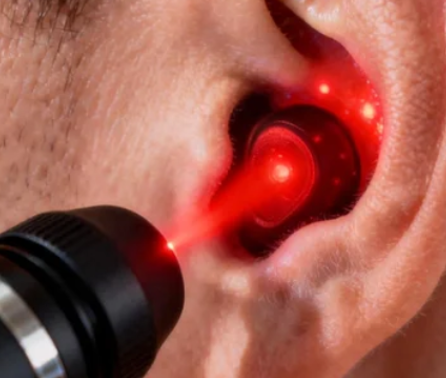 How Does 650nm Light Therapy Alleviate Tinnitus?