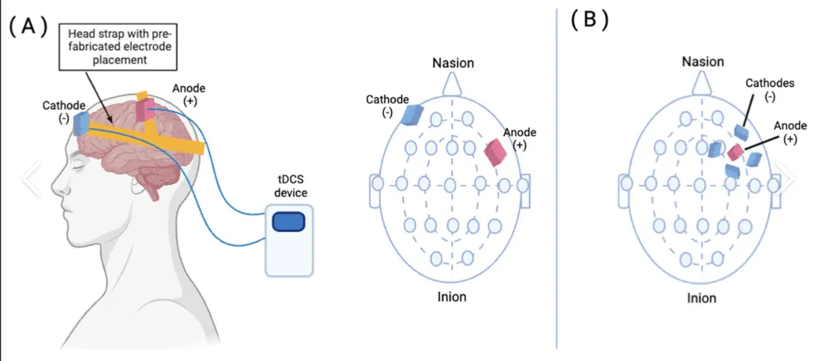 Mechanisms of Action for Treating Alzheimer&rsquo;s Disease with Triple Wavelengths