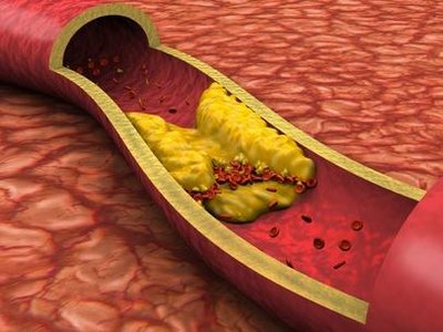semiconductor laser treatment and various symptoms disease relationship