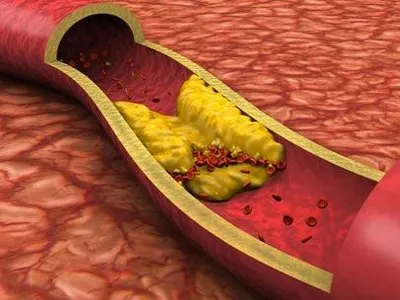 semiconductor laser treatment and various symptoms disease relationship